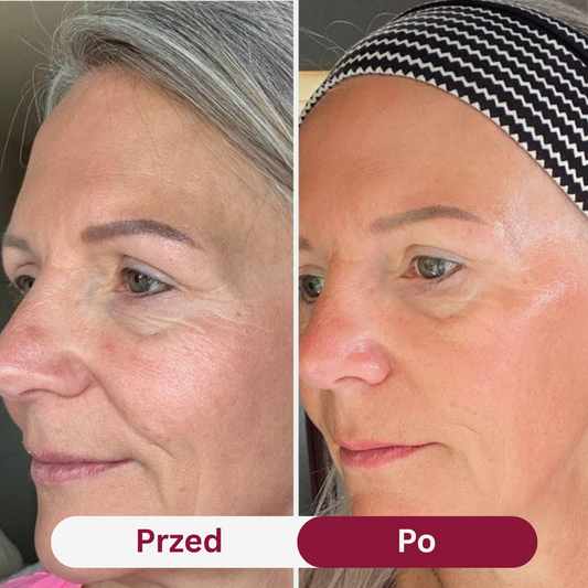 Odmładzająca Maska Kolagenowa Lashley™ Dla Skóry 35+